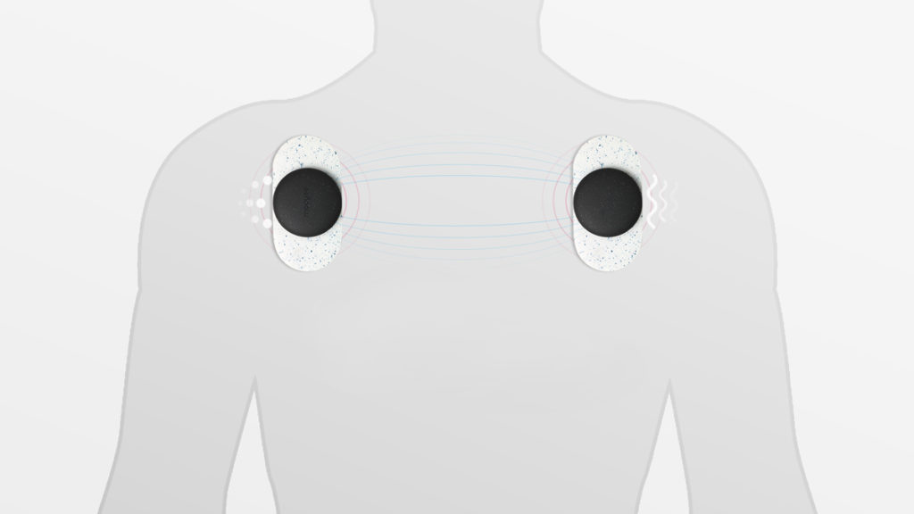 Tens Ems Ismanioji Raumenu Stimuliacija Veikimo Principas Desktop